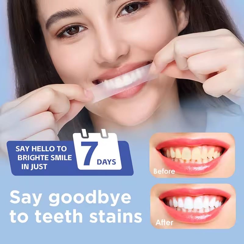 Y-TEN Teeth Whitening Strips – Safe, Gentle & Effective Whitening